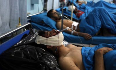 Photo of men receiving treatment after a suicide bombing