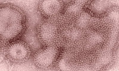 Photo of H3N2 influenza virions