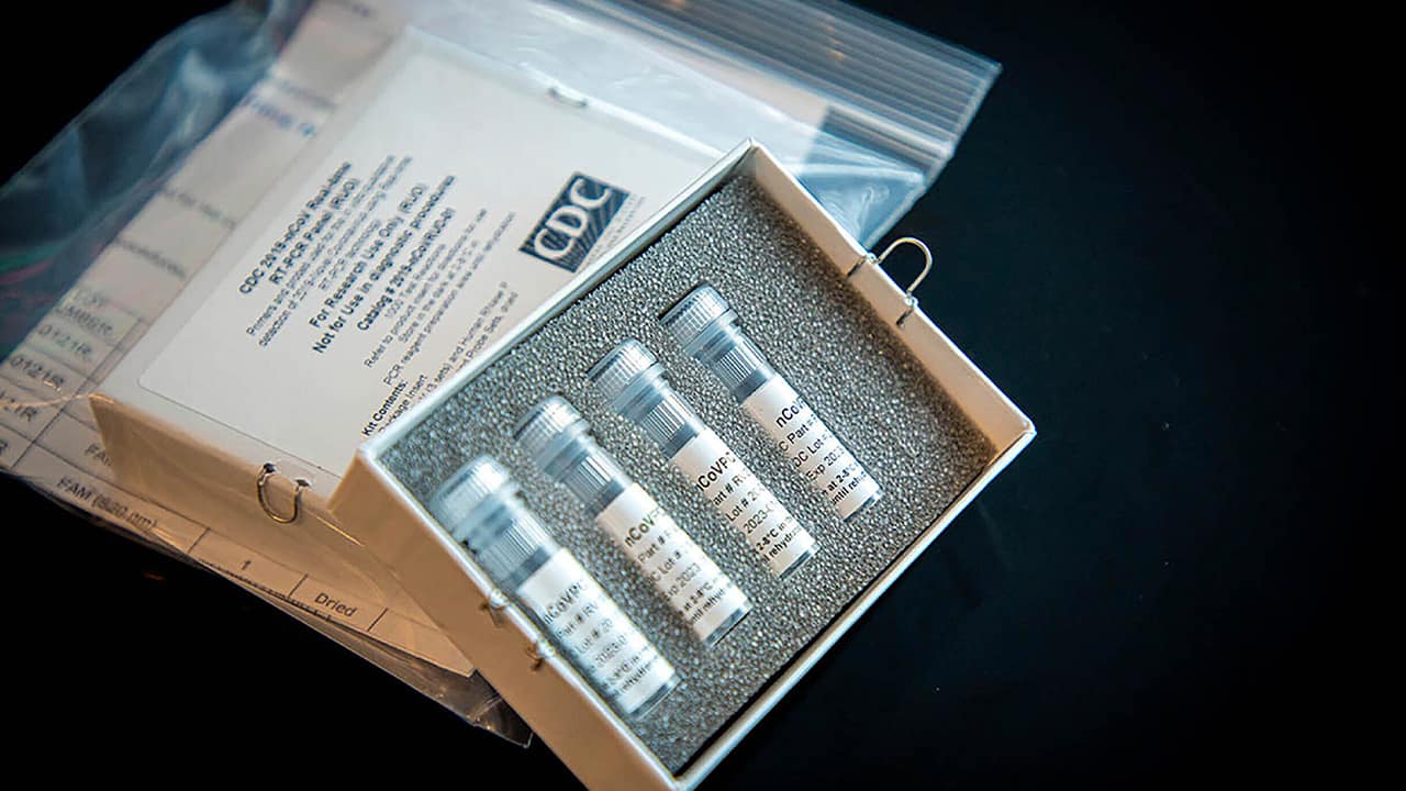 Photo of CDC test kits