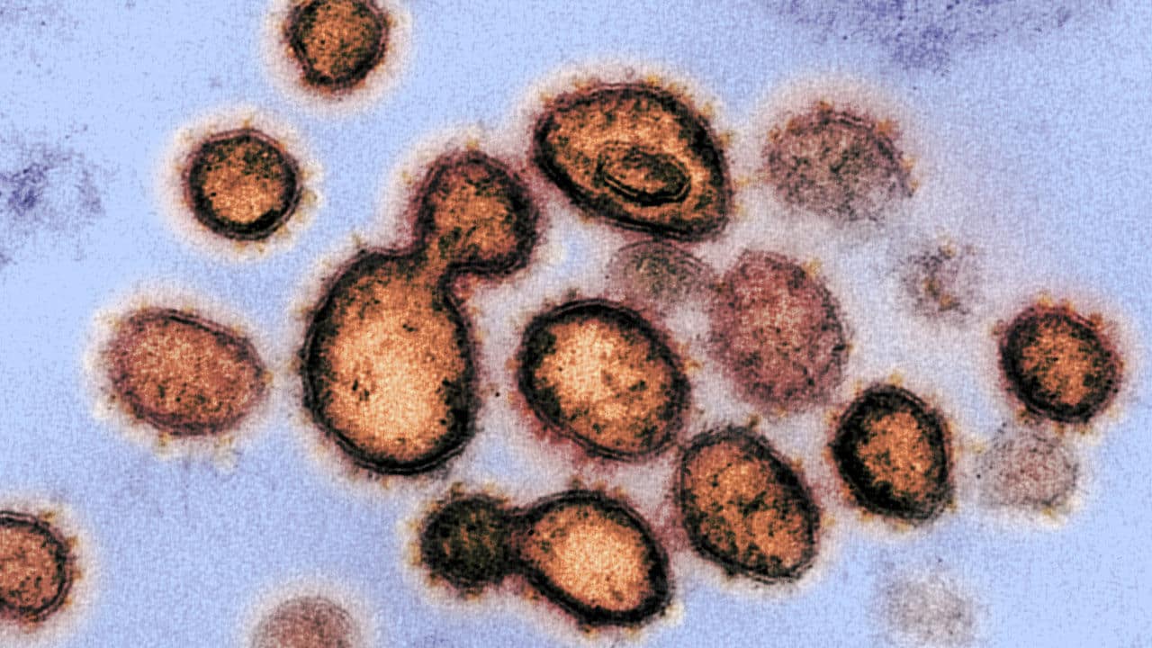 Photo of severe acute respiratory syndrome coronavirus 2, the virus that causes coronavirus disease 2019, isolated from a patient