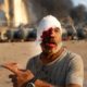 Photo of an injured man